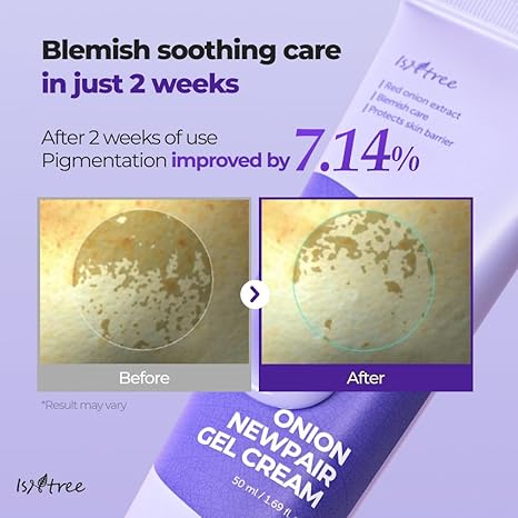 Isntree Onion Newpair Gel Cream – 50ml - Image 4