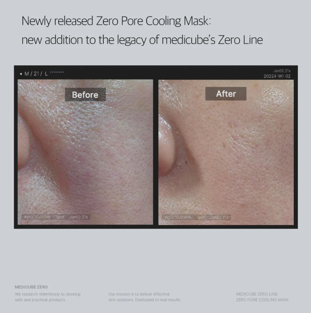Medicube Zero Pore Cooling Mask 1 Piece - Image 3